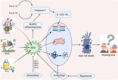 Mitochondrial dysfunction in hearing loss: Oxidative stress, autophagy and NLRP3 inflammasome